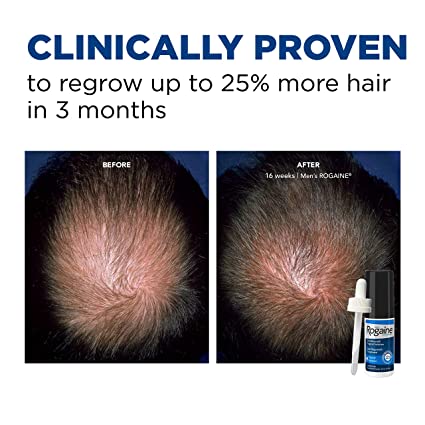 7384642890316a8932bb8186c8a239df_051822225353.jpeg Men's Rogaine Extra Strength 5% раствор миноксидила для местного применения при выпадении и возобновлении роста волос, средство для местного лечения истонченных волос, запас на 1 месяц