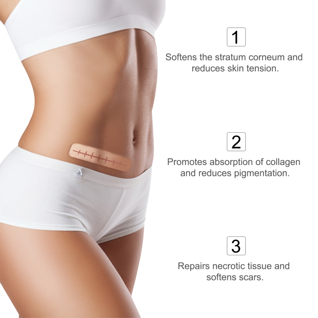 7ec7024f0ef22d031b6e6140e62c0c15_113022234304.png Elaimei 120-дюймовый силиконовый валик от рубцов, силиконовая лента для удаления рубцов